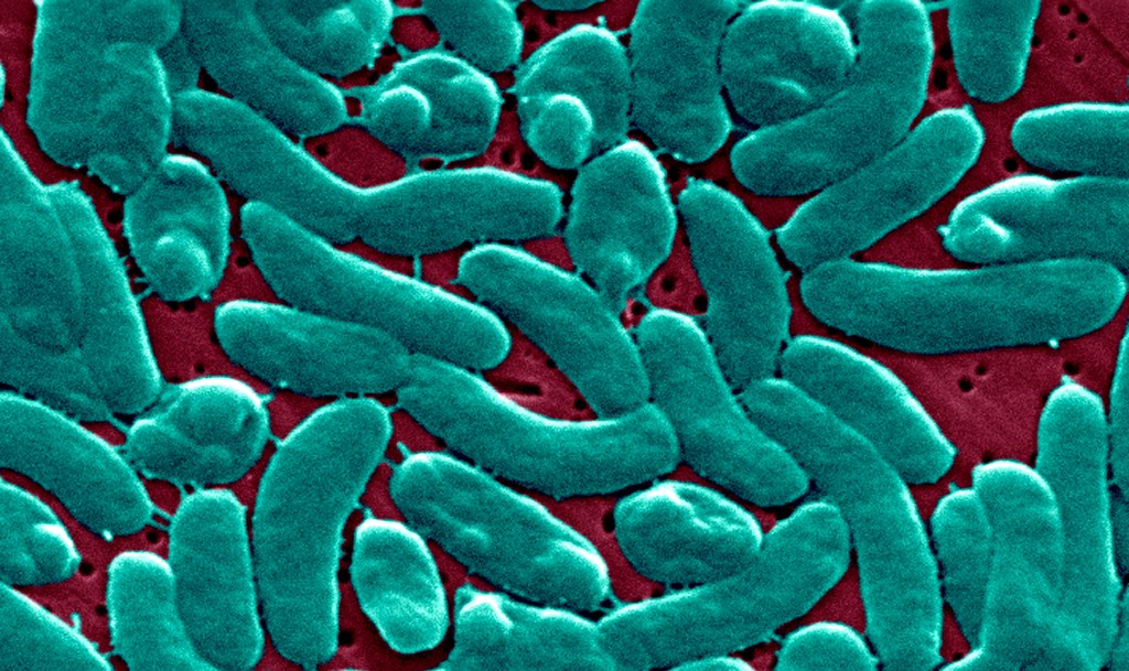 13184x vibrio vulnificus bacterium family 30264753 gAQ2Eu